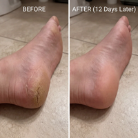 Deep-Repair Sakura Heel Balm